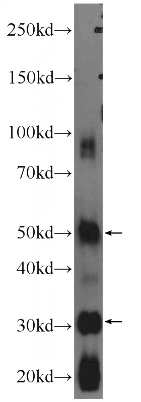 rat testis tissue were subjected to SDS PAGE followed by western blot with Catalog No:113324(ODF1 Antibody) at dilution of 1:600