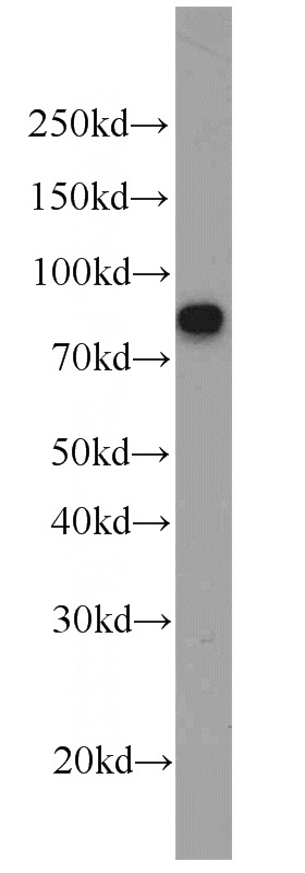 Raji cells were subjected to SDS PAGE followed by western blot with Catalog No:111813(IVL antibody) at dilution of 1:500