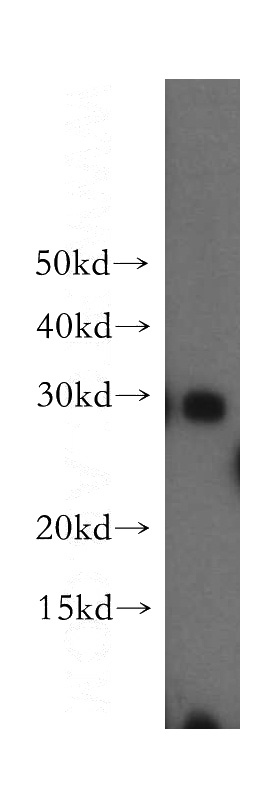 HeLa cells were subjected to SDS PAGE followed by western blot with Catalog No:112780(MTIF3 antibody) at dilution of 1:500