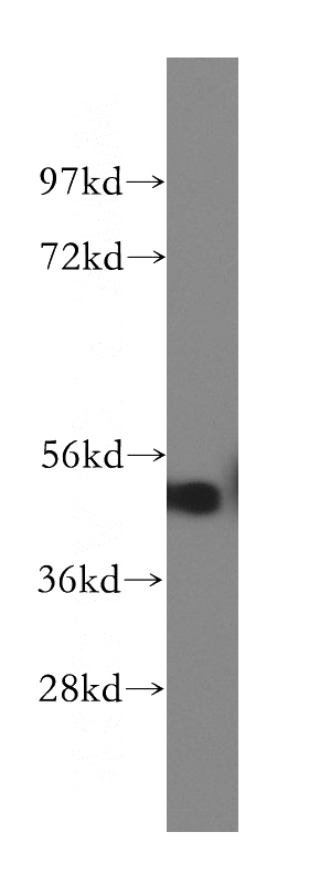 mouse testis tissue were subjected to SDS PAGE followed by western blot with Catalog No:114637(RGMA antibody) at dilution of 1:400