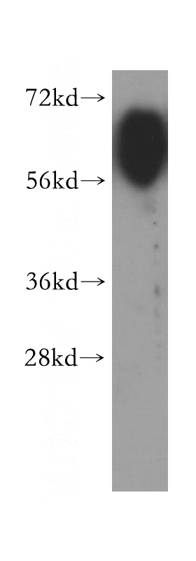 mouse testis tissue were subjected to SDS PAGE followed by western blot with Catalog No:114345(PVRL3, Nectin 3 antibody) at dilution of 1:400