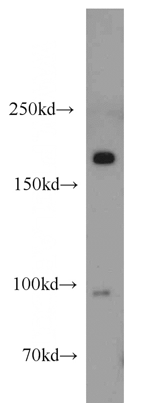 human skeletal muscle tissue were subjected to SDS PAGE followed by western blot with Catalog No:112426(MAP4K4 antibody) at dilution of 1:1000