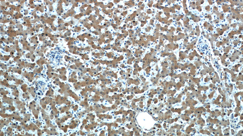 Immunohistochemistry of paraffin-embedded human liver slide using Catalog No:114638(RGN,SMP30 Antibody) at dilution of 1:50