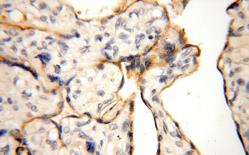Immunohistochemical of paraffin-embedded human placenta using Catalog No:112298(LOX antibody) at dilution of 1:100 (under 40x lens)