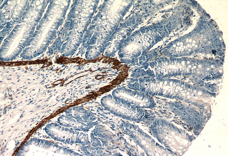 Immunohistochemistry of paraffin-embedded human colon slide using Catalog No:107862(ACTA1 Antibody) at dilution of 1:50