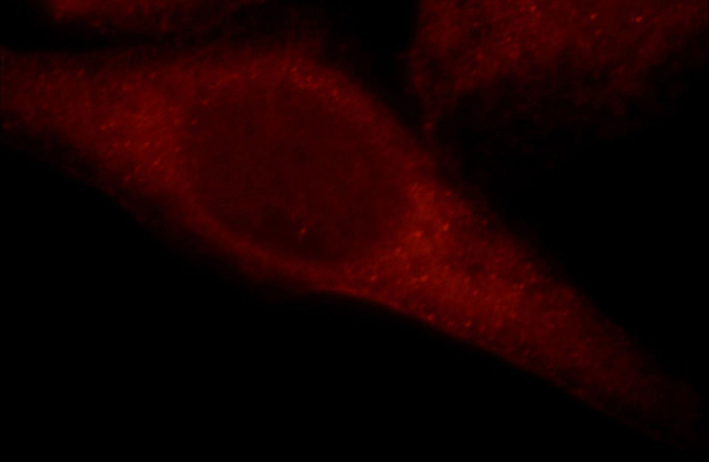 Immunofluorescent analysis of Hela cells, using MAP3K4 antibody Catalog No:112476 at 1:25 dilution and Rhodamine-labeled goat anti-rabbit IgG (red).