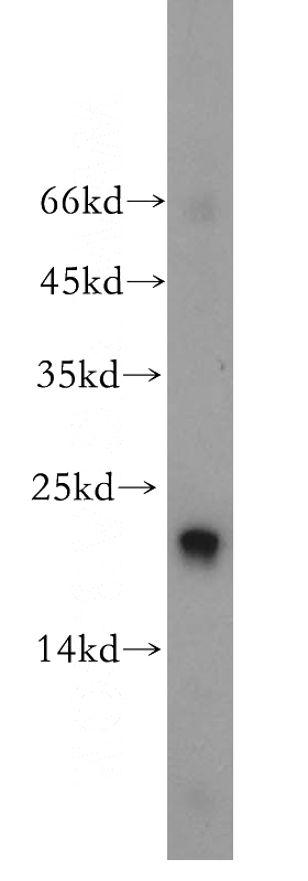 human heart tissue were subjected to SDS PAGE followed by western blot with Catalog No:114124(PPIF-Specific antibody) at dilution of 1:1000