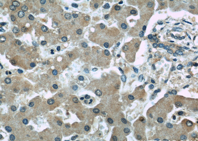 Immunohistochemical of paraffin-embedded human liver using Catalog No:107646(TRPC4AP antibody) at dilution of 1:50 (under 40x lens)