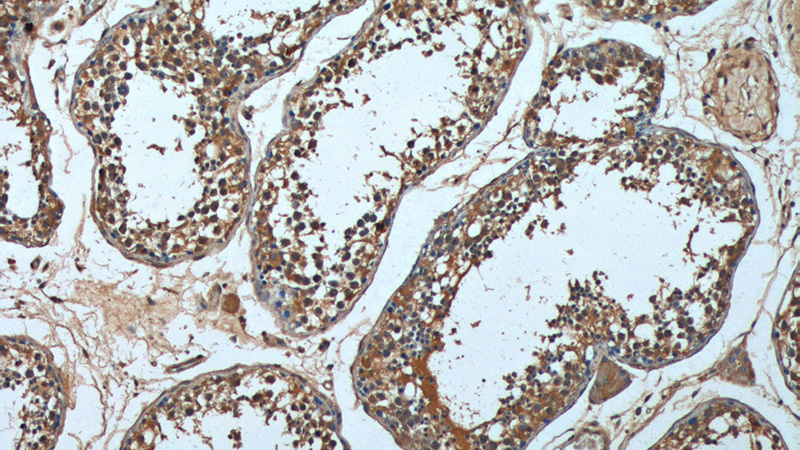 Immunohistochemistry of paraffin-embedded human testis tissue slide using Catalog No:107269(HSPA2 Antibody) at dilution of 1:200 (under 10x lens).