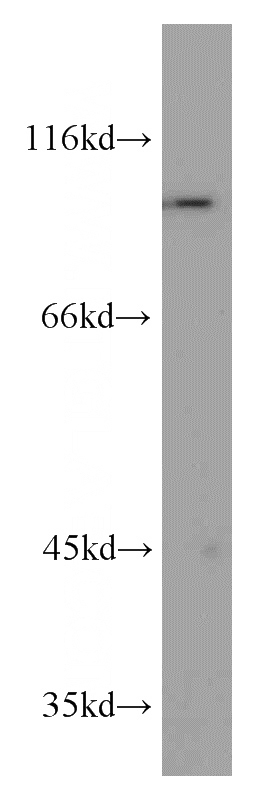 A549 cells were subjected to SDS PAGE followed by western blot with Catalog No:114358(PYGB antibody) at dilution of 1:500