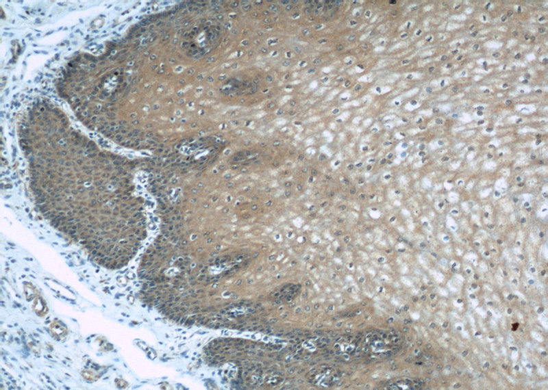 Immunohistochemical of paraffin-embedded human oesophagus using Catalog No:114010(PLS3 antibody) at dilution of 1:50 (under 10x lens)