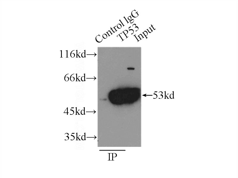 IP Result of anti-P53 (IP:Catalog No:113553, 4ug; Detection:Catalog No:113553 1:1000) with A431 cells lysate 3000ug.