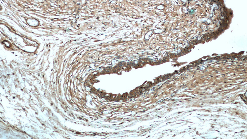Immunohistochemical of paraffin-embedded human bladder using Catalog No:113019(NALP3 antibody) at dilution of 1:200 (under 10x lens)