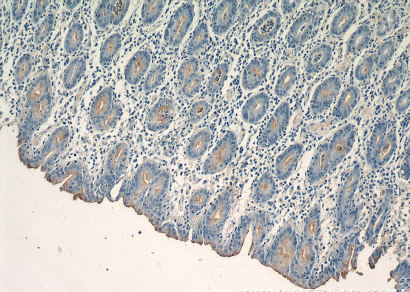 Immunohistochemistry of paraffin-embedded human stomach tissue slide using Catalog No:108997(CCKAR-specific Antibody) at dilution of 1:50 (under 10x lens)