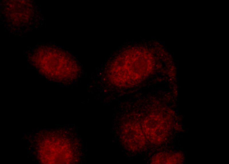 Immunofluorescent analysis of HepG2 cells using Catalog No:115222(SETD2 Antibody) at dilution of 1:50 and Rhodamine-Goat anti-Rabbit IgG