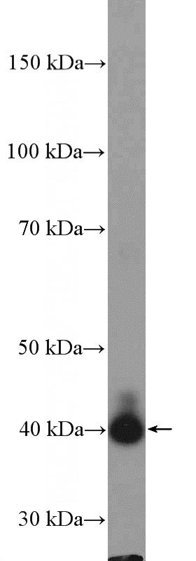 rat liver tissue were subjected to SDS PAGE followed by western blot with Catalog No:114989(SCD Antibody) at dilution of 1:300