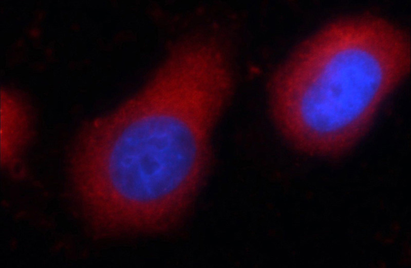 Immunofluorescent analysis of HeLa cells using Catalog No:107549(ZYX Antibody) at dilution of 1:50 and Rhodamine-Goat anti-Mouse IgG