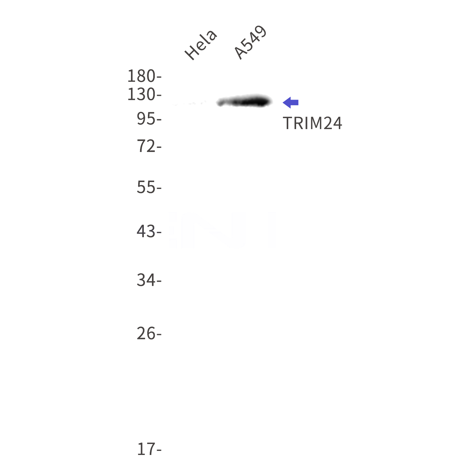 Western blot detection of TRIM24 in Hela,A549 cell lysates using TRIM24 Rabbit mAb(1:1000 diluted).Predicted band size:117kDa.Observed band size:117kDa.