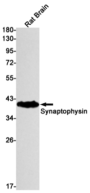 Western blot detection of Synaptophysin in Rat Brain lysates using Synaptophysin Rabbit mAb(1:1000 diluted).Predicted band size:34kDa.Observed band size:38kDa.