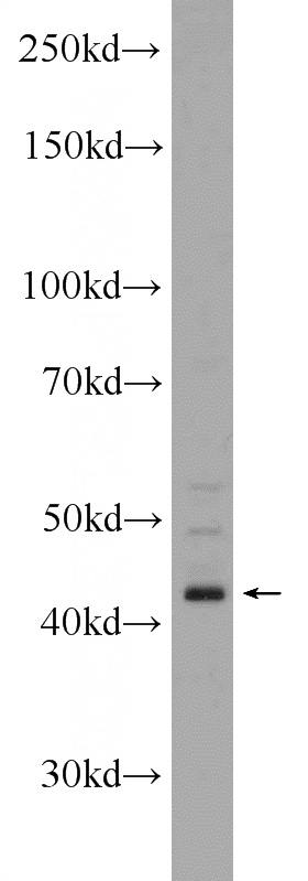 SH-SY5Y cells were subjected to SDS PAGE followed by western blot with Catalog No:115633(ST8SIA1 Antibody) at dilution of 1:1000