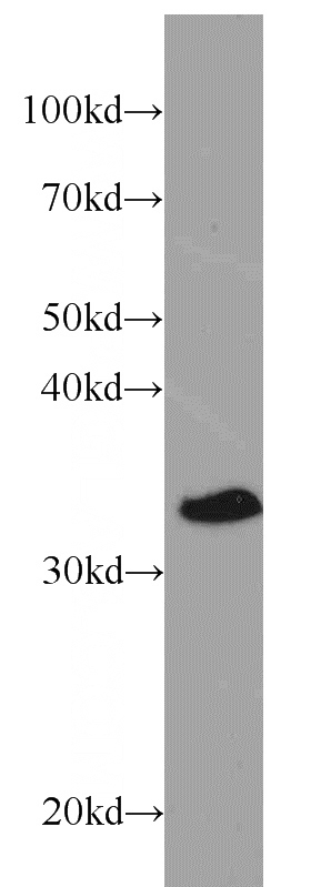mouse heart tissue were subjected to SDS PAGE followed by western blot with Catalog No:109235(CHMP4B antibody) at dilution of 1:200