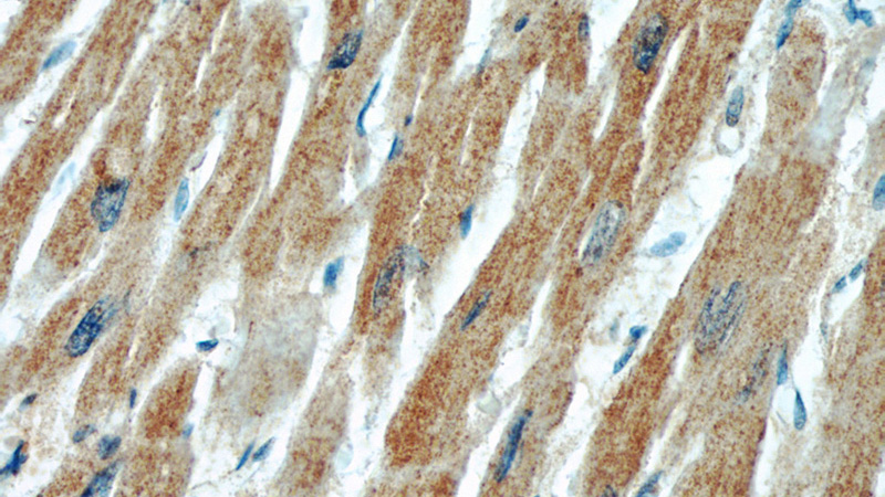 Immunohistochemical of paraffin-embedded human heart using Catalog No:112530(MFN2 antibody) at dilution of 1:50 (under 40x lens)