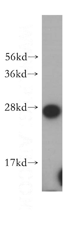 human kidney tissue were subjected to SDS PAGE followed by western blot with Catalog No:113521(OVCA2 antibody) at dilution of 1:200