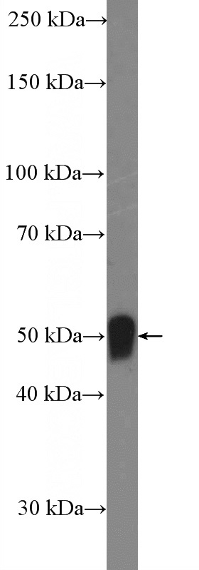 human adipose tissue were subjected to SDS PAGE followed by western blot with Catalog No:115197(SERPINA12 Antibody) at dilution of 1:1000