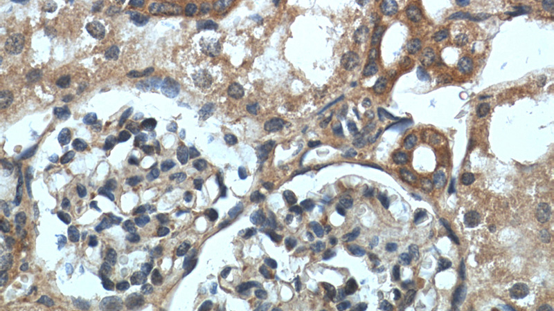 Immunohistochemistry of paraffin-embedded human kidney slide using Catalog No:111460(HRAS-Specific Antibody) at dilution of 1:50