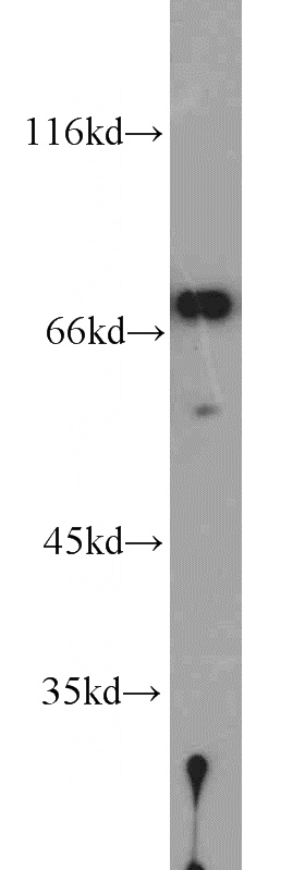mouse testis tissue were subjected to SDS PAGE followed by western blot with Catalog No:113474(PABPC1,PABP antibody) at dilution of 1:1000