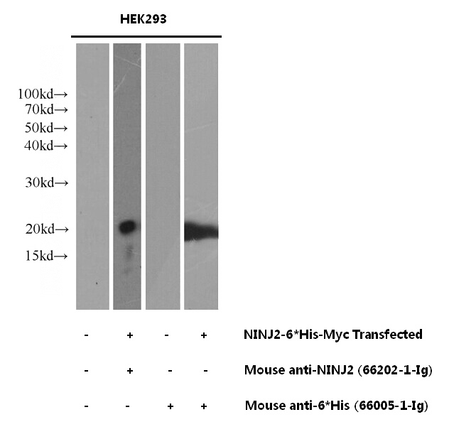 Untransfected and NINJ2 transfected HEK-293 cells were subjected to SDS-PAGE followed by western blot with Catalog No:107333 (mouse anti-NINJ2 monoclonal antibody,1:1000) and mouse anti-6*His tag respectively.