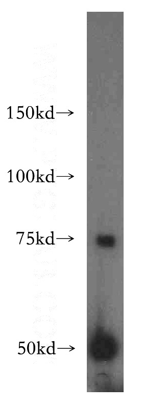 human liver tissue were subjected to SDS PAGE followed by western blot with Catalog No:108400(BAAT antibody) at dilution of 1:500