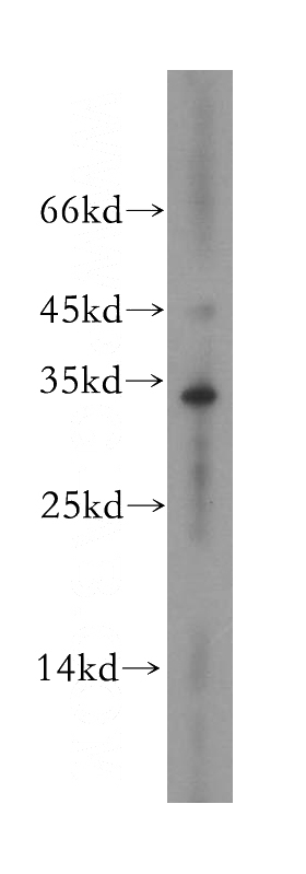human brain tissue were subjected to SDS PAGE followed by western blot with Catalog No:112755(MPPED2 antibody) at dilution of 1:800