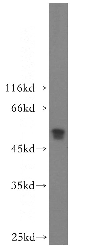 A431 cells were subjected to SDS PAGE followed by western blot with Catalog No:113086(NDUFV1 antibody) at dilution of 1:500