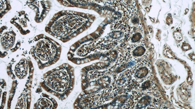 Immunohistochemistry of paraffin-embedded human small intestine tissue slide using Catalog No:116837(WNT6 Antibody) at dilution of 1:50 (under 10x lens)