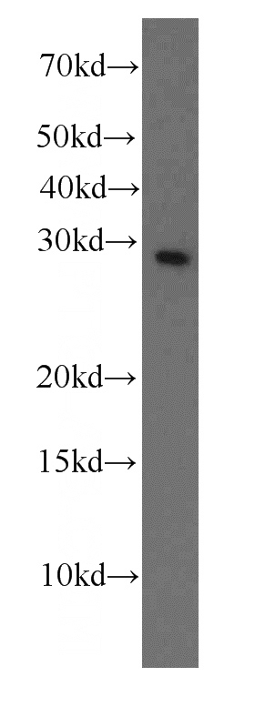 K-562 cells were subjected to SDS PAGE followed by western blot with Catalog No:107199(F12 antibody) at dilution of 1:1000
