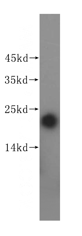 Jurkat cells were subjected to SDS PAGE followed by western blot with Catalog No:112603(MGMT antibody) at dilution of 1:1000