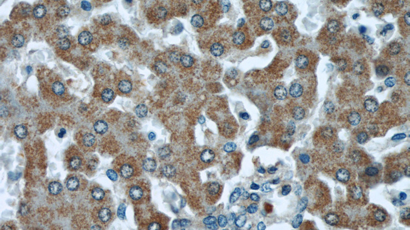 Immunohistochemical of paraffin-embedded human liver using Catalog No:107628(TMEM70 antibody) at dilution of 1:50 (under 40x lens)