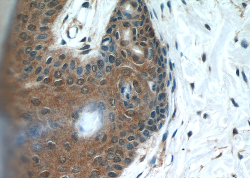 Immunohistochemical of paraffin-embedded human skin using Catalog No:112368(MAD2L1BP antibody) at dilution of 1:50 (under 40x lens)