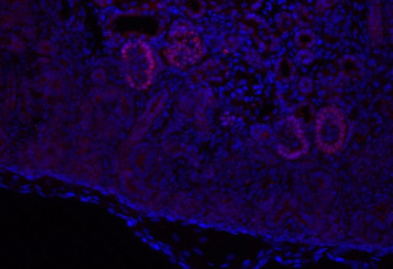 IF result of anti-LMX1B(Catalog No:112288 ,1:900) with embryonic kidney by Dr. Joo-Seop Park. Red: Podocytes, anti-rabbir Alexa555; Blue: Hoechst.