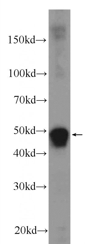 human testis tissue were subjected to SDS PAGE followed by western blot with Catalog No:109182(CEP55 Antibody) at dilution of 1:1000