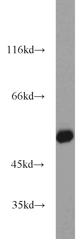HEK-293 cells were subjected to SDS PAGE followed by western blot with Catalog No:117267(ZSCAN21 antibody) at dilution of 1:1000