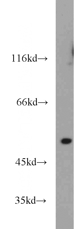 mouse thymus tissue were subjected to SDS PAGE followed by western blot with Catalog No:109228(CHK1 antibody) at dilution of 1:1000