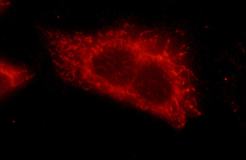 Immunofluorescent analysis of HeLa cells using Catalog No:111335(hamartin Antibody) at dilution of 1:25 and Rhodamine-Goat anti-Rabbit IgG