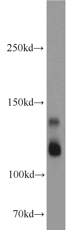 human brain tissue were subjected to SDS PAGE followed by western blot with Catalog No:112473(MAP1S antibody) at dilution of 1:1000