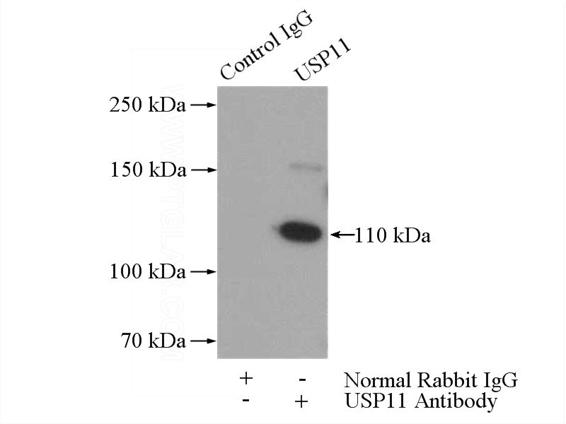 IP Result of anti-USP11 (IP:Catalog No:116588, 4ug; Detection:Catalog No:116588 1:300) with HEK-293 cells lysate 1480ug.