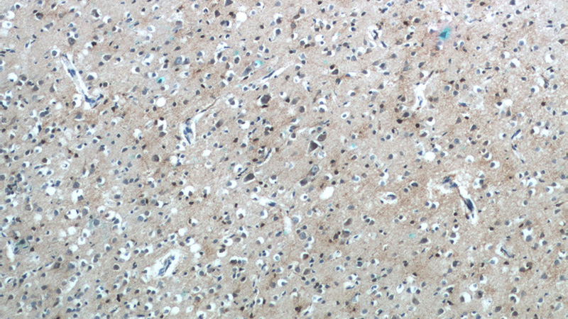 Immunohistochemistry of paraffin-embedded human brain tissue slide using Catalog No:109305(CHURC1 Antibody) at dilution of 1:50 (under 10x lens)