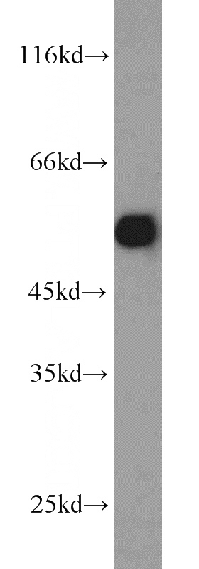BxPC-3 cells were subjected to SDS PAGE followed by western blot with Catalog No:113680(PDHX antibody) at dilution of 1:5000
