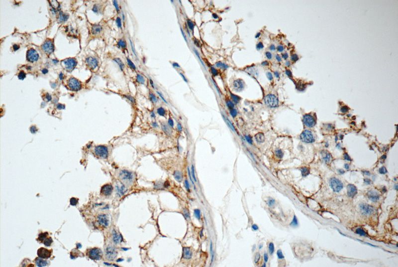 Immunohistochemistry of paraffin-embedded human testis tissue slide using Catalog No:111172(GSK3B Antibody) at dilution of 1:50 (under 40x lens)