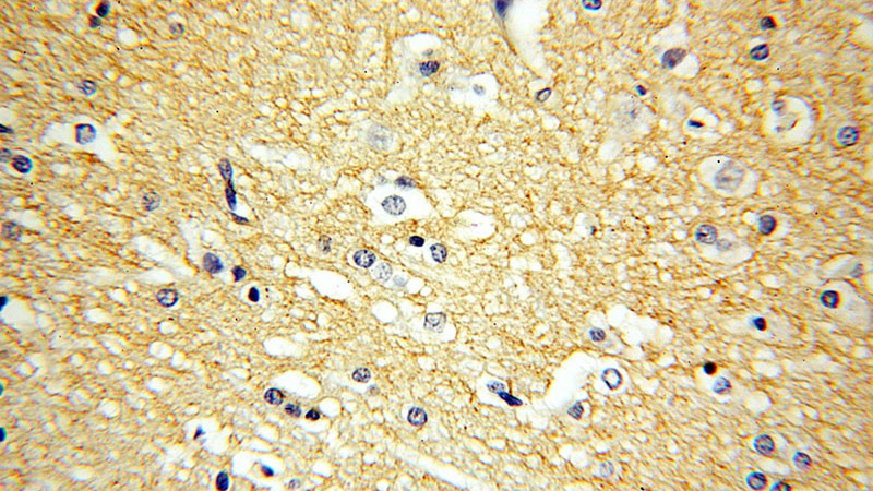 Immunohistochemical of paraffin-embedded human brain using Catalog No:111066(GPM6A antibody) at dilution of 1:50 (under 40x lens)